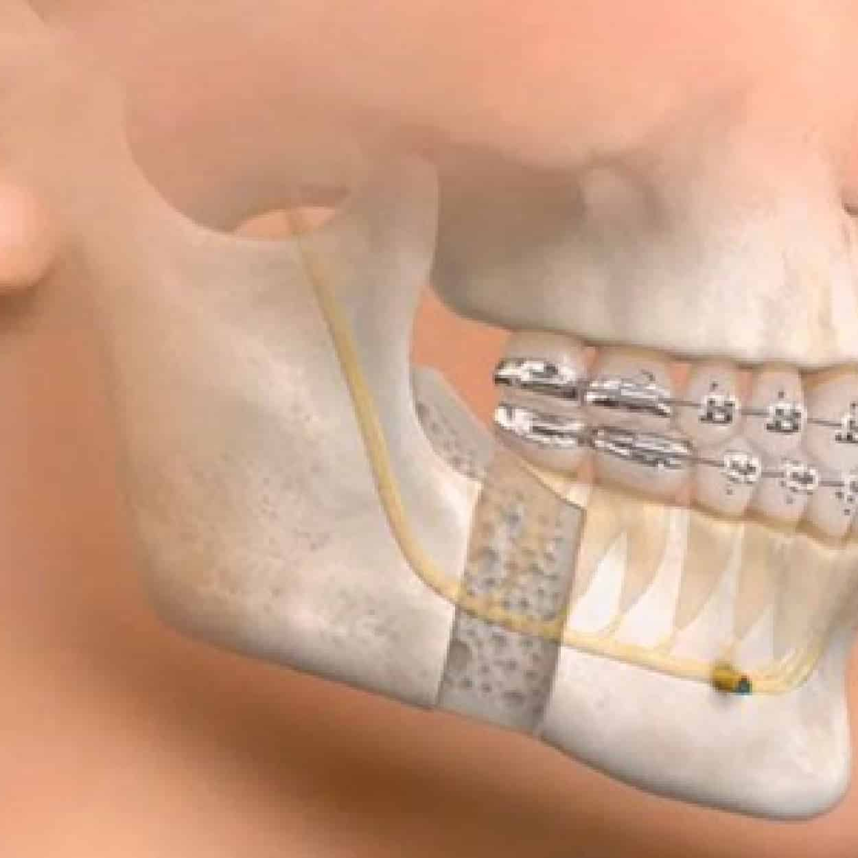 Maxillofacial Surgery